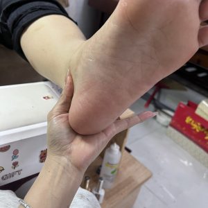 Chà gót chân nứt nẻ tại Kim Loan Beauty Hòa Thành Tây Ninh